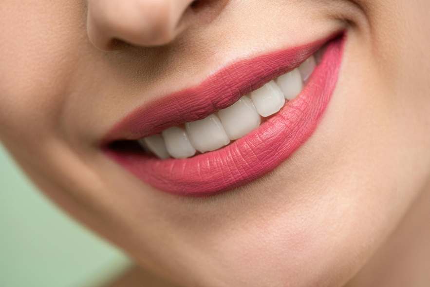 Teeth whitening service