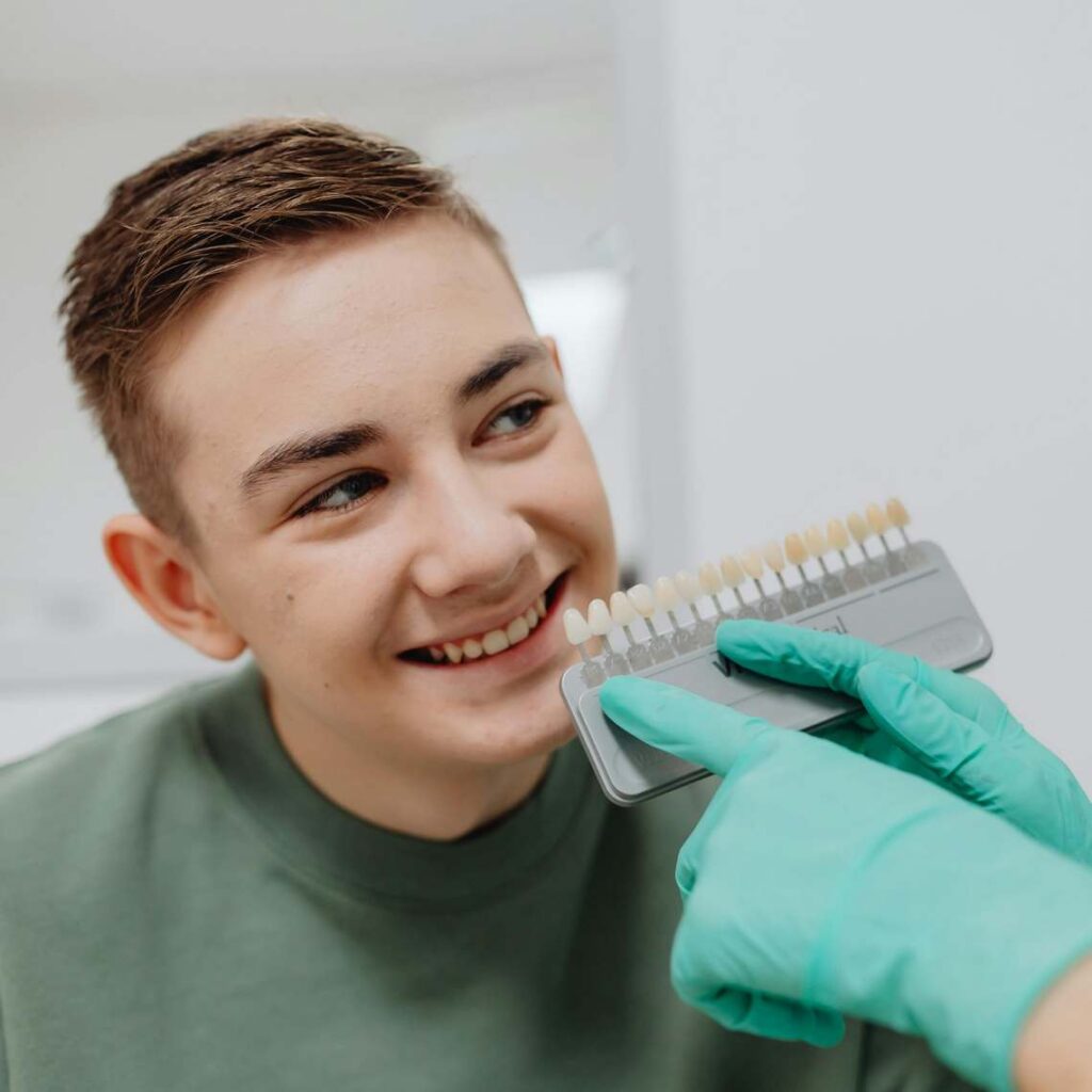 teeth whitening service